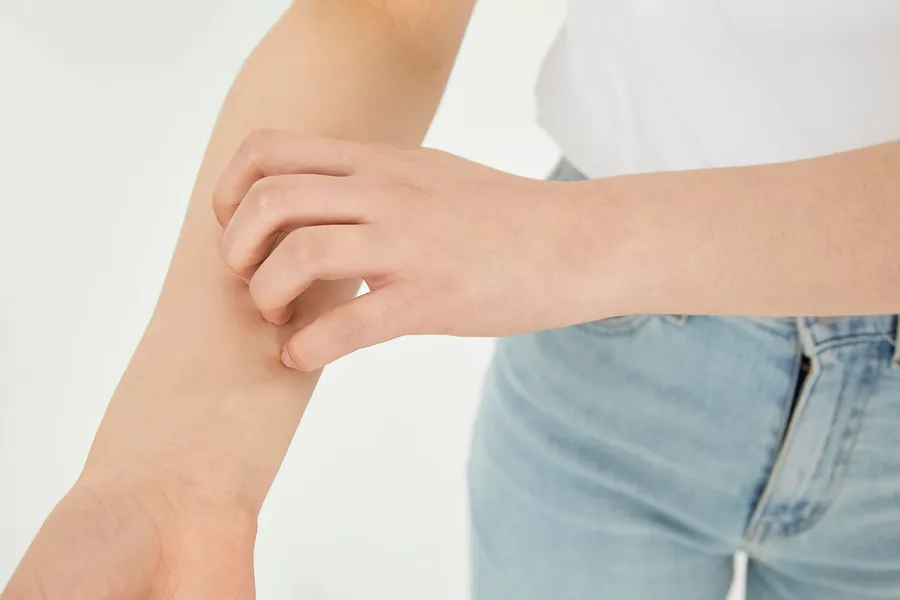 低温やけどの症状