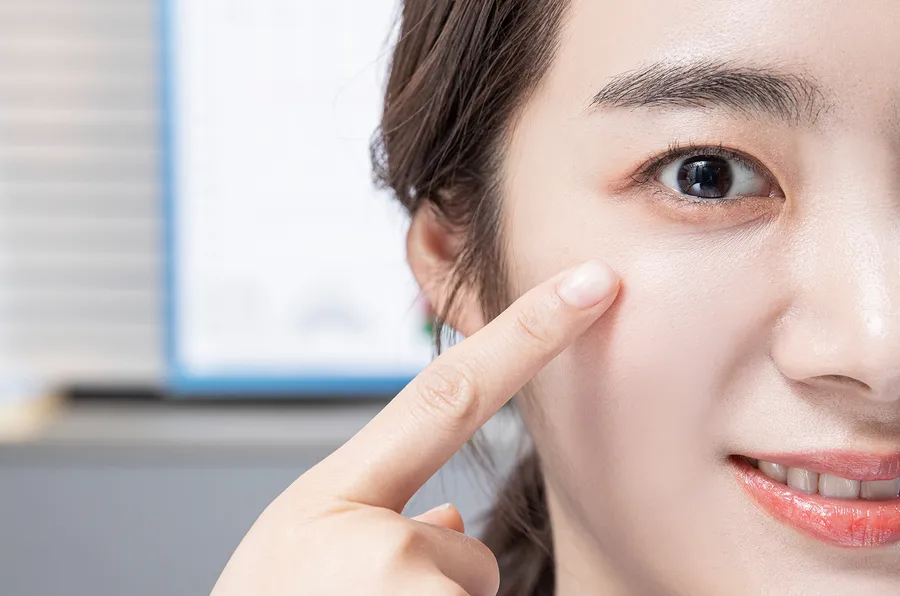 リレックススマイル費用