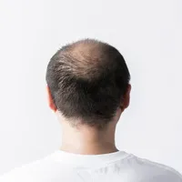 「AGA治療はオンライン診療で薬を処方してもらえますか?」