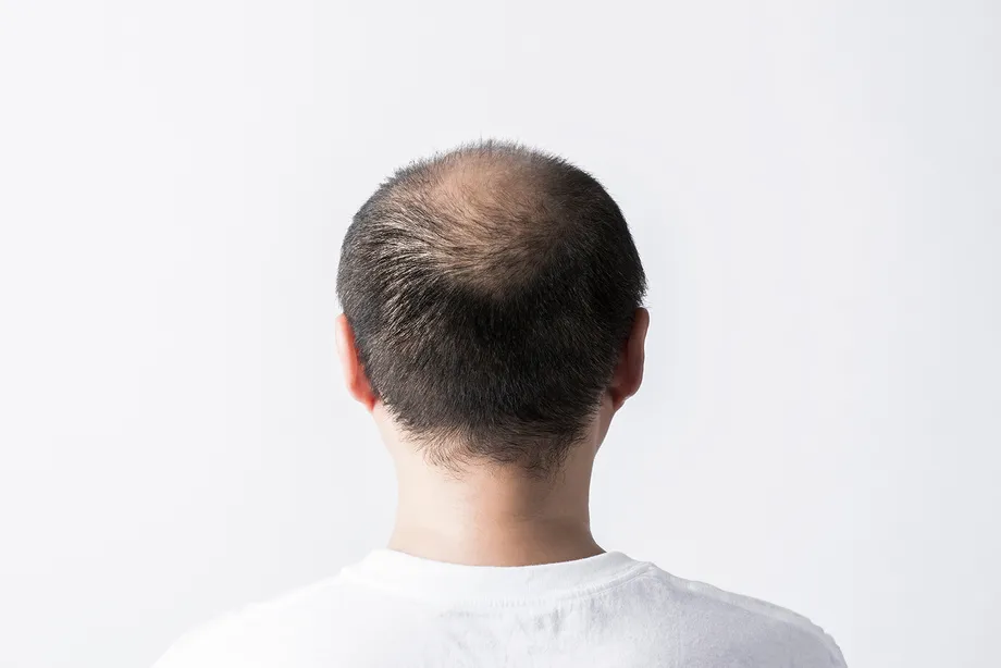 「AGA治療はオンライン診療で薬を処方してもらえますか?」