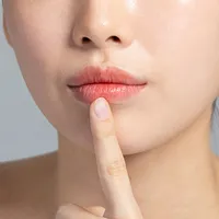 口唇炎 vs 口唇ヘルペス、違いは何でしょうか?