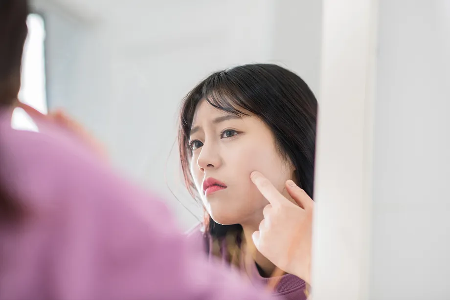 イソトレチノインの効果はいつから現れるのか?イソトレチノインの効果、副作用について解説
