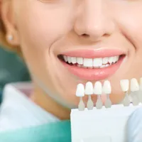 セルフホワイトニング vs 歯科でのホワイトニング、違いは何? 歯のホワイトニングの効果と注意点