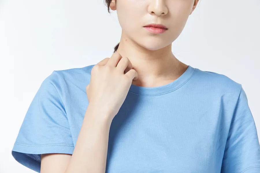 皮膚かゆみの原因