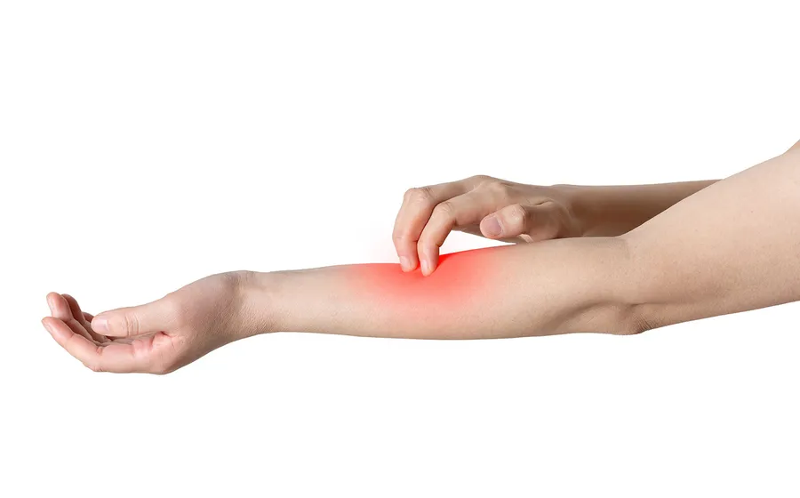 妊娠中の皮膚のかゆみ