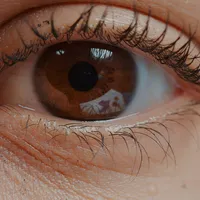 視力低下を招く『角膜炎』の初期症状、治療期間、結膜炎との違い